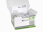 Sample Preparation Kits from BIOTECON Diagnostics