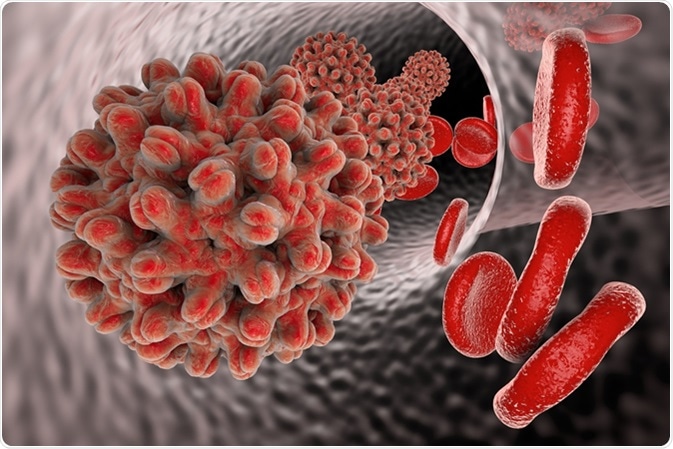 Hepatitis B virus in blood vessel with red blood cells. A model of virus is built using data of viral macromolecular structure furnished by Protein Data Bank (PDB 4G93). Image Credit: Kateryna Kon / Shutterstock