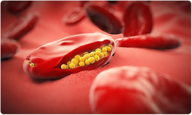 Plasmodium falciparum merozoites bursting out of an infected red blood cell