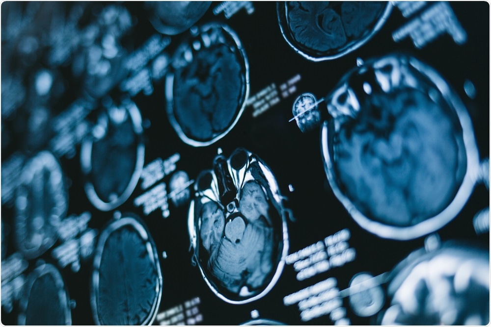 Two dimensional X-ray film of the brain