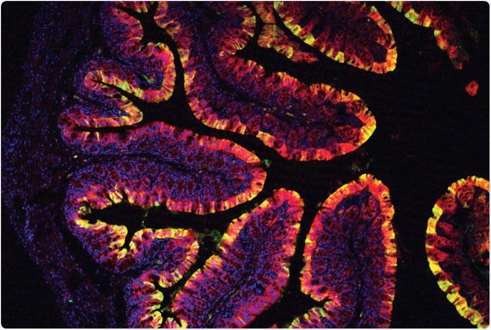 Colon cells with activated AhR highlighted