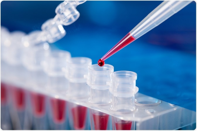 PCR tubes - By science photo