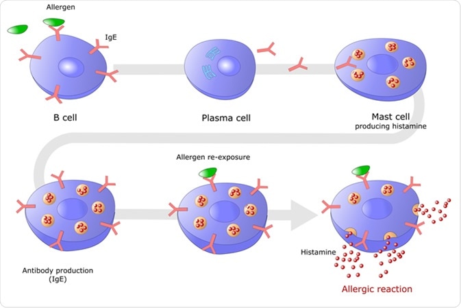 Allergic reaction mediated via E type Immunoglobulin (IgE) with histamine production - Image Credit: ellepigrafica / Shutterstock