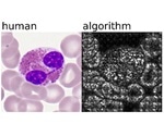 New AI-driven approach for single blood cell classification