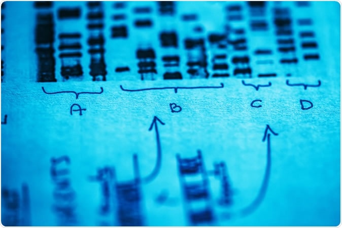 Image Credit: isak55 / Shutterstock