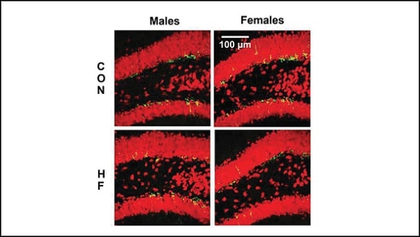 High fat diet limits birth and development of new neurons in female mice