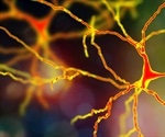 Could high cholesterol lead to motor neuron disease?