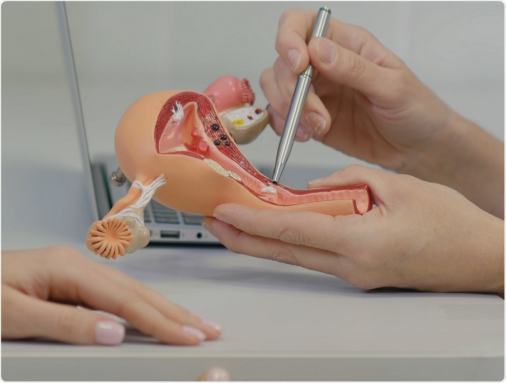 Doctor explaining structure of the ovaries to patient