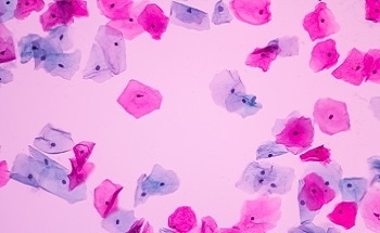 Cervical cancer cells