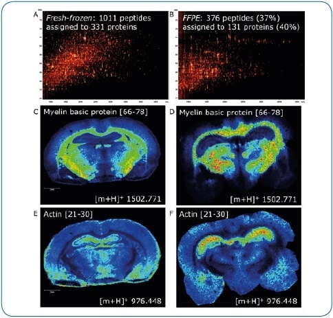 Fresh-frozen vs. FFPE tissue. ImageID is a powerful tool to evaluate on-tissue digests. Here, we compare fresh-frozen and FFPE rat brain tissue. Except for antigen retrieval (20 minutes at 110 °C, pH 6), digest and matrix application (using a TM-Sprayer) were identical. The lower number of peptides generated on FFPE tissue (376 or 37% compared to fresh-frozen) indicates digestion is less efficient (A, B). In addition, antigen retrieval introduces further delocalization of peptides as seen by the slight loss of lateral resolution in the FFPE experiment (D, F) when compared to fresh-frozen (C, E). Matching LC-MALDI data to the imaging data using ImageID, we could assign only 23% (235, fresh-frozen) and 57% (214, FFPE) of LC-MALDI peptides to peaks in the imaging data, indicating that extraction and incorporation of peptides during matrix application requires improvement.