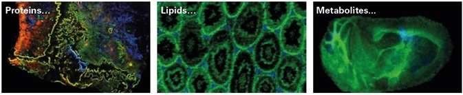 MALDI Imaging can simultaneously map hundreds of different compounds within a small region or across large cohorts of samples.