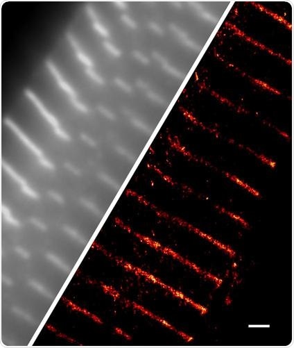 A single isolated Wistar rat cardiomyocyte stained against α-actinin​. Scale bar - 1 µm