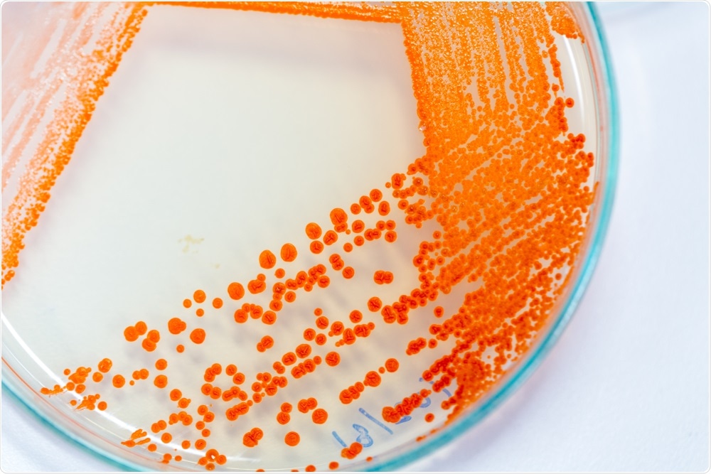 Synbiosis offer rapid antibiotic analysis tools