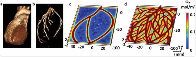 Imaging of the heart and patch modeling. CT image of a) a human heart and b) left ventricle coronary arteries. c) A model of oxygen concentration profile in an engineered patch. d) Replanning of the model showed better oxygen diffusion, sufficient to support cell viability.