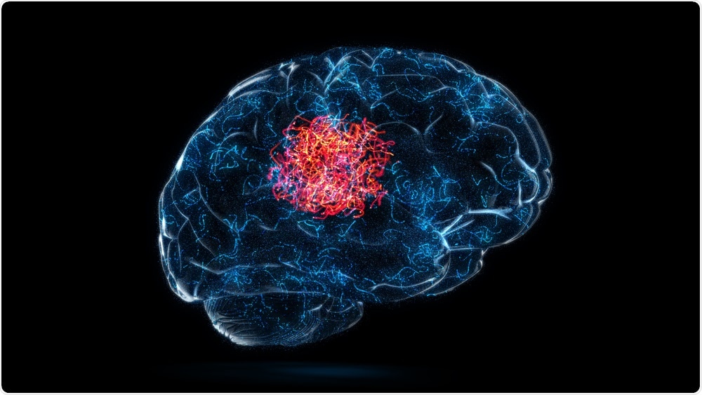 A man who developed scoliosis as a teenager has developed ways to cope with chronic pain without using pain medication.