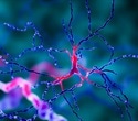 Study finds small sex differences in recovery after ischemic stroke