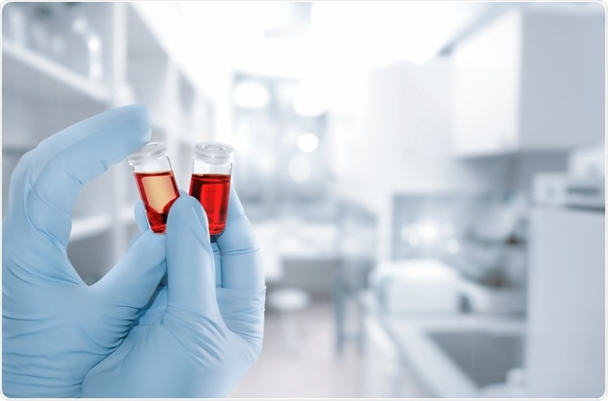 Image Credit: Anyaivanova / Shutterstock