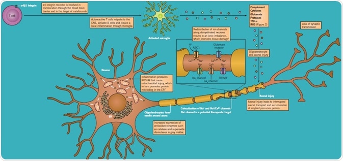 Mechanisms of demyelination and axon degeneration in MS.