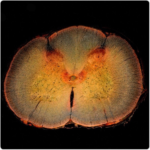 New computational model explores daily pain sensitivity rhythms