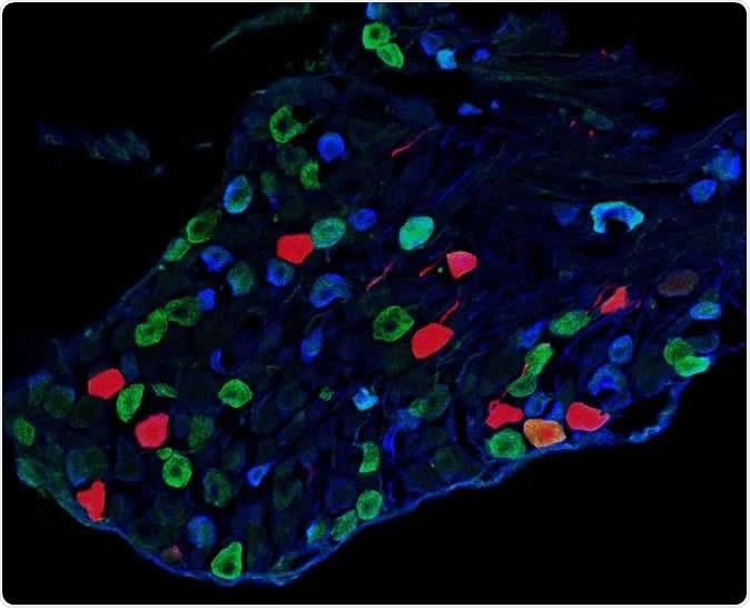 This is a cross-section from a dorsal root ganglion showing sensory neurons that transmit light-touch information from the skin to Y1 neurons within the spinal cord. Image Credit: Salk Institute