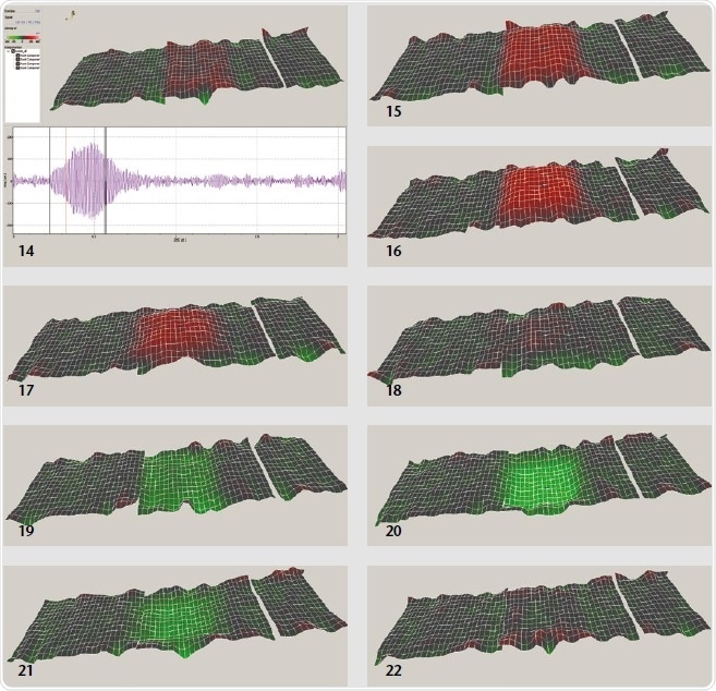 Vibration Characteristics of the highfrequency ultrasound sensor.