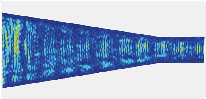 Vibrometer scan revealing the amplitude of vibrations in a phononic cone, able to focus the energy at specific locations. Scan of ca 190 000 points at 9.35 MHz. [Reboud J., et al, Lab Chip, 2012, 1268-73] – scale bar is 200 μm.