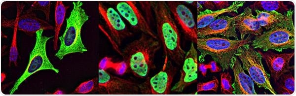 HeLa cells expressing PHLPP (left), the segment with the nuclear localization signal (middle), and that same segment mutated (right). Image Credit: UC San Diego School of Medicine