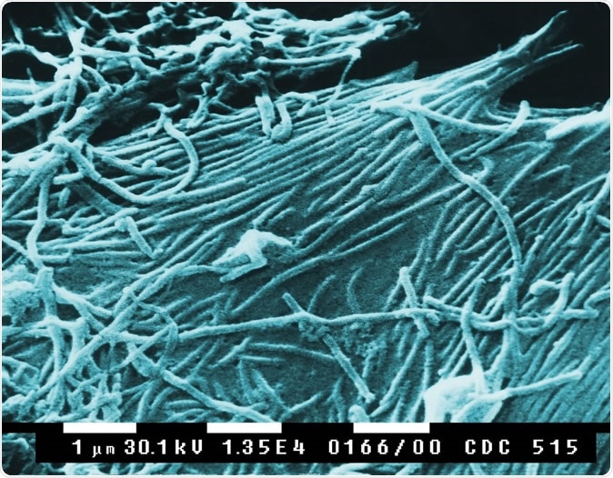 Ebola virions (virus particles). Ebola hemorrhagic fever is a severe, often-fatal disease Image Credit: Everett Historical / Shutterstock