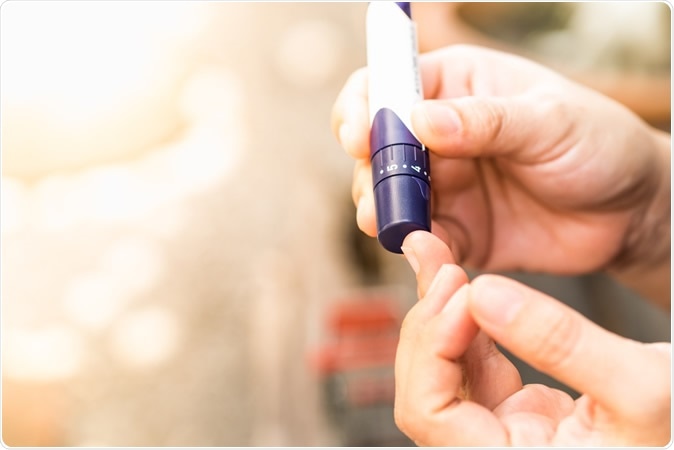 Image Credit: Montri Thipsorn / Shutterstock