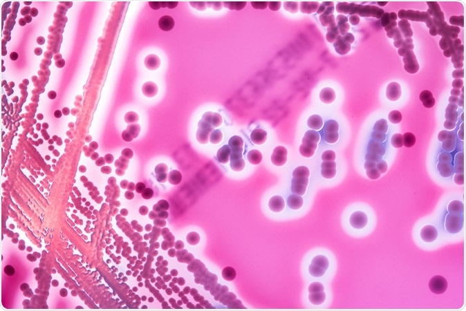 Close up of petri dish with colony of Streptococcus bacteria. Image Credit: Stastny_Pavel / Shutterstock