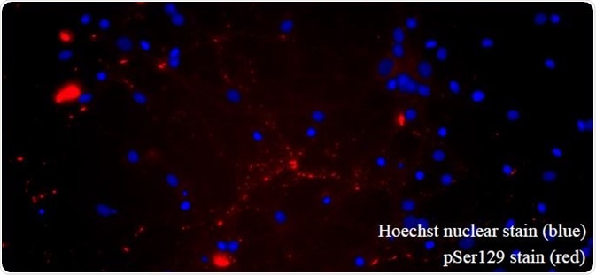 A53T PFFs seed α-synucleinpathology in primary rat hippocampal neurons. (SPR-326).