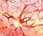 New genetic screen for Huntington’s disease