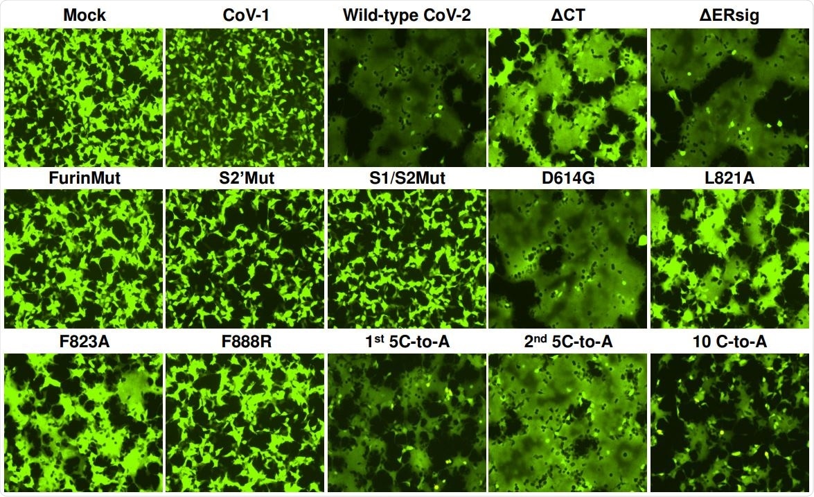 293T-ACE2 cells were transfected either with a plasmid expressing enhanced green fluorescent protein (eGFP) alone (Mock) or with the eGFP-expressing plasmid and a plasmid expressing SARS-CoV-1 S gp or wild-type or mutant SARS-CoV-2 S glycoproteins. After 24 hours, the cells were examined under a fluorescent microscope. The results shown are representative of those obtained in two independent experiments.