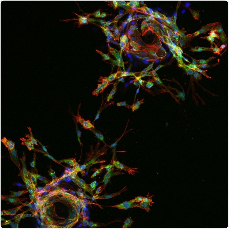 Study provides new insight into unknown effects of factors that regulate blood vessel formation