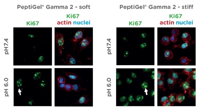 Characterization of Pancreatic Cancer Cells Response to Peptigels that Mimic Healthy and Tumour Tissue Properties