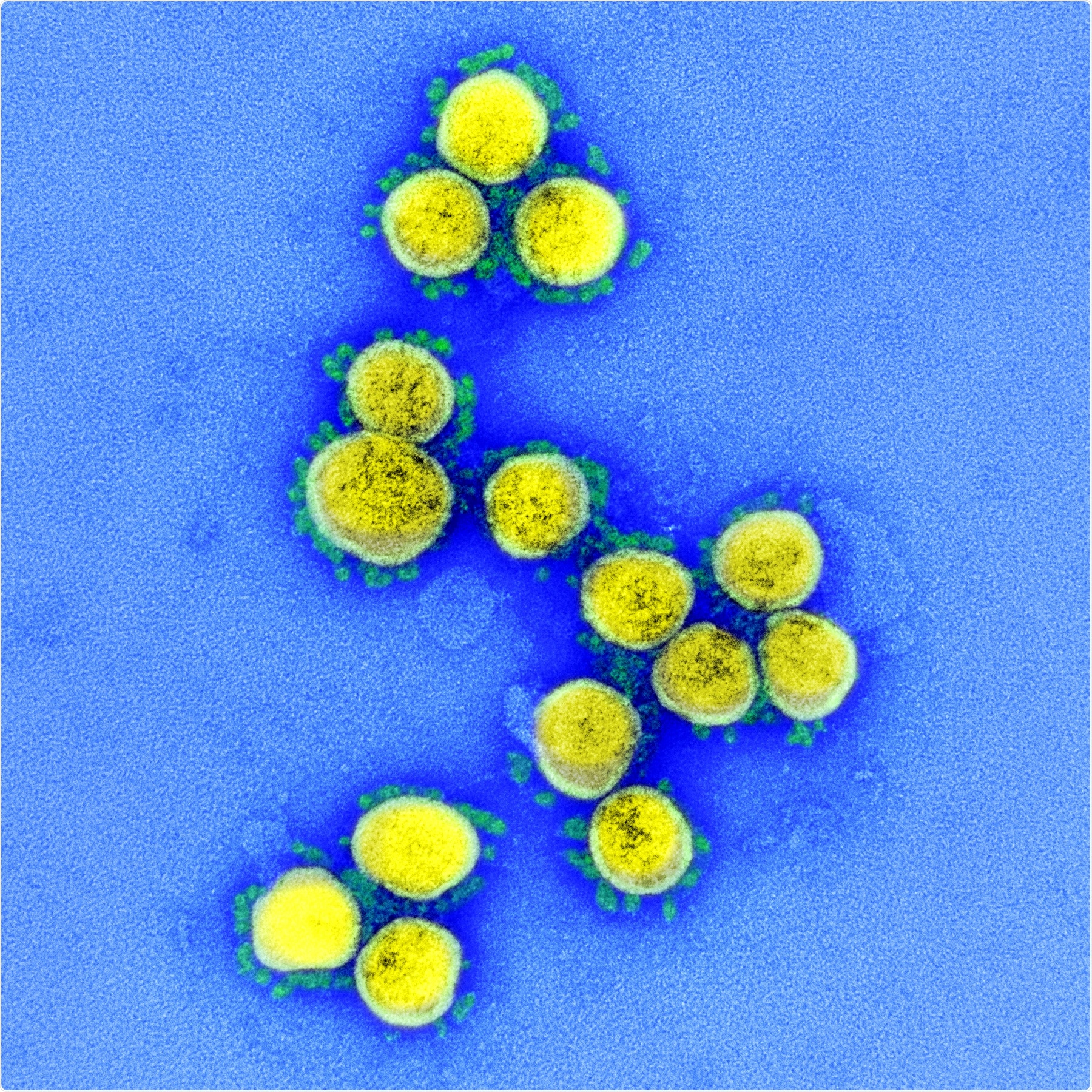 Transmission electron micrograph of SARS-CoV-2 virus particles, isolated from a patient. Image captured and color-enhanced at the NIAID Integrated Research Facility (IRF) in Fort Detrick, Maryland. Credit: NIAID
