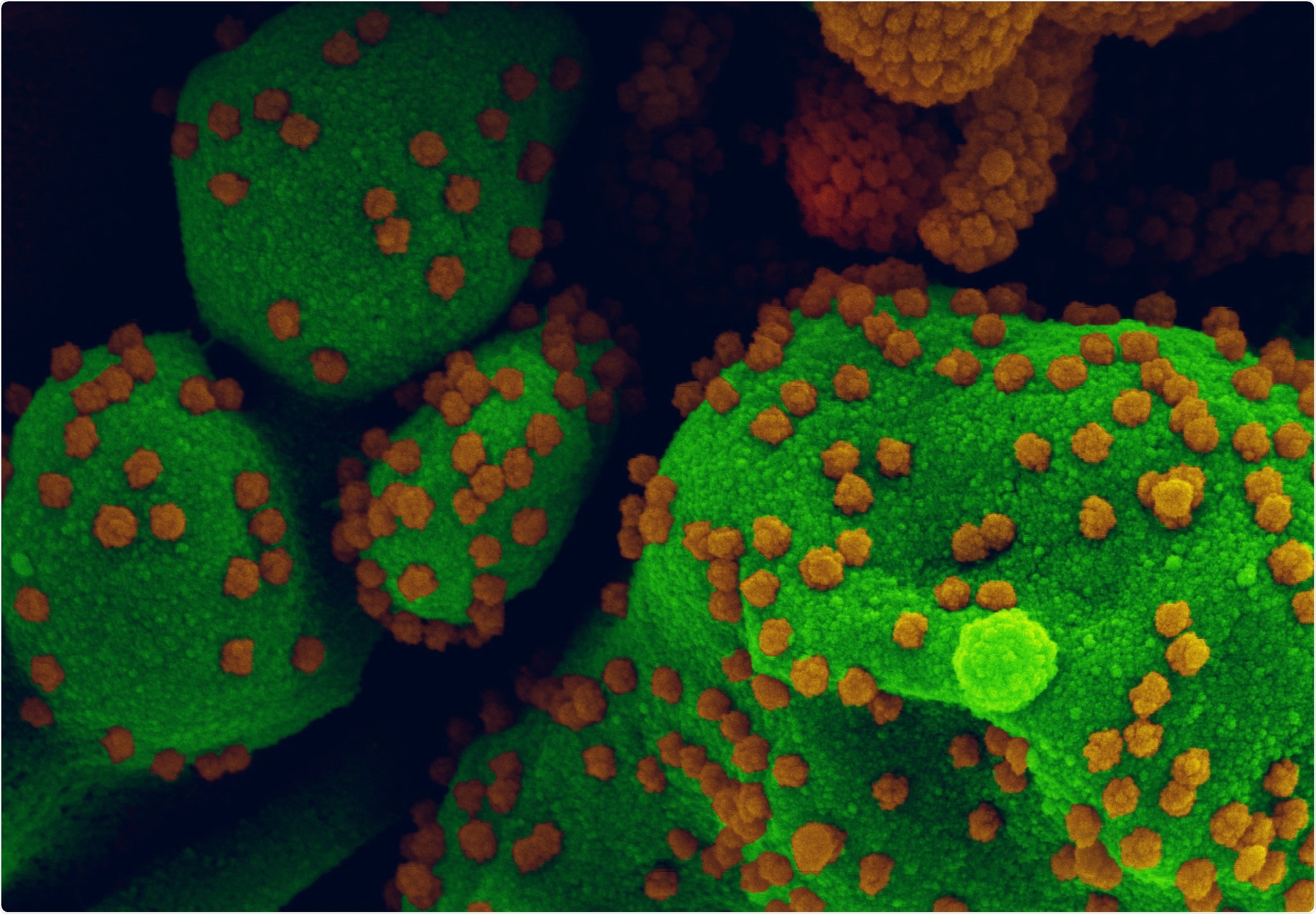 Study: Timing the SARS-CoV-2 Index Case in Hubei Province. Image Credit: NIAID Integrated Research Facility (IRF) in Fort Detrick, Maryland.