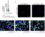 Animal study suggests palmitoylation inhibitor reduces virulence of SARS-CoV-2