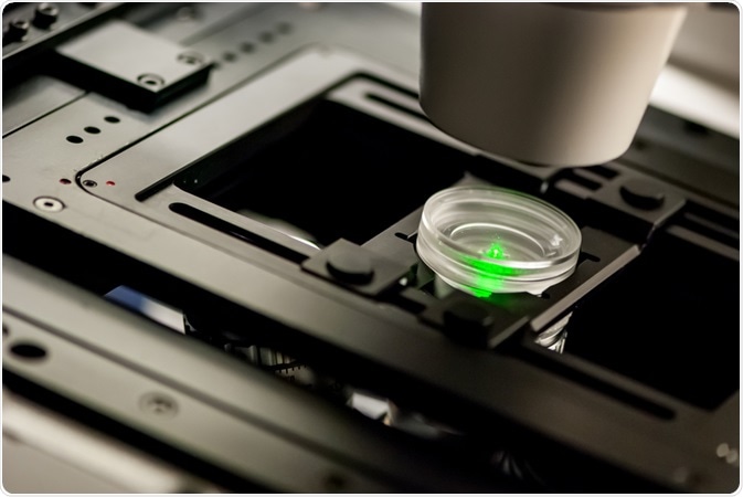 fluorescence microscopy