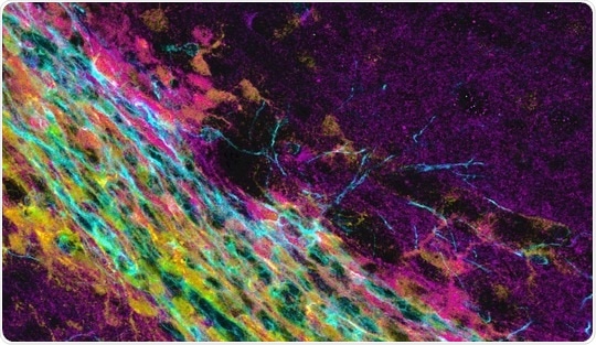 Defining neurogenic niche proteome helps identify key regulators of neurogenesis