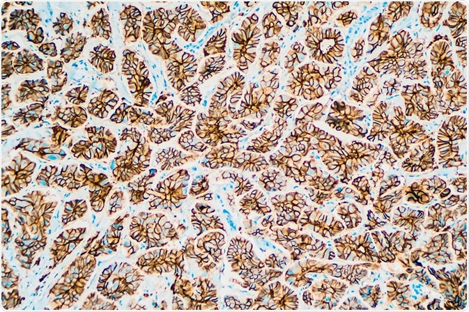 Immunohistochemistry