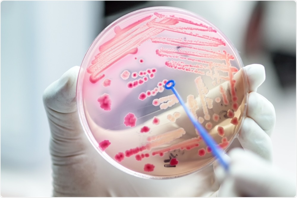 Antibiotic resistant bacteria on agar plate - diagnosis