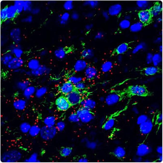 Representative confocal microscope image of the ventral horn of the spinal cord from an ALS mouse. Several microglial cells (green) infiltrate the spinal cord as ALS disease progresses. Single molecule FISH detected IRF7 (an interferon-inducible gene) RNA molecules (red) in microglia and other cells (Credit: Valeria Gerbino/Maniatis lab/Columbia’s Zuckerman Institute).