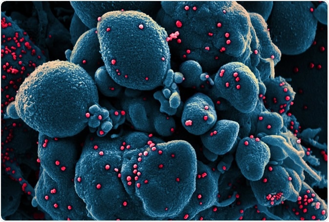 Novel Coronavirus SARS-CoV-2 Colorized scanning electron micrograph of an apoptotic cell (blue) infected with SARS-COV-2 virus particles (red), isolated from a patient sample. Image captured at the NIAID Integrated Research Facility (IRF) in Fort Detrick, Maryland. Credit: NIAID
