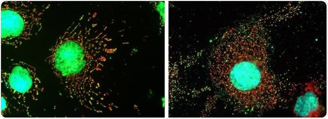 The image at left shows normal cells with tubular mitochondria (red), and DNA (green) in the nucleus and within the mitochondria. At right, MxB has been removed by genetic means and leaves fragmented mitochondria (red) with its genome displaced into the cytoplasm. Image Credit: Mayo Clinic