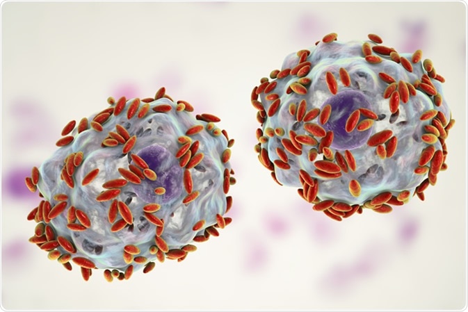 Microscopic diagnosis of bacterial vaginosis. Vaginal secretions contain epithelial cells, so-called clue cells covered with bacteria Gardnerella vaginalis, 3D illustration Credit: Kateryna Kon / Shutterstock