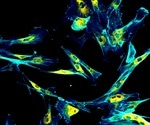 What are Fibroblasts?