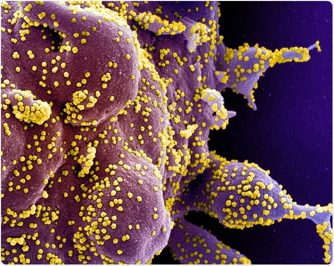 Novel Coronavirus SARS-CoV-2 Colorized scanning electron micrograph of an apoptotic cell (purple) heavily infected with SARS-COV-2 virus particles (yellow), isolated from a patient sample. Image captured at the NIAID Integrated Research Facility (IRF) in Fort Detrick, Maryland. Credit: NIAID