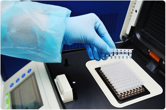Study: Smart Pooled sample Testing for COVID-19: A Possible Solution for Sparsity of Test Kits. Image Credit: Evgeniy Kalinovskiy / Shutterstock