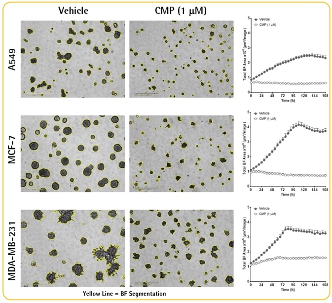 Multi-Spheroid 3D Tumor Assays Development for Live-Cell Analysis